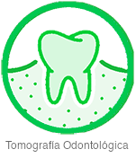 Tomografía Odontológica