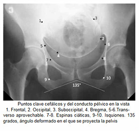 Radiografía Digital Simple