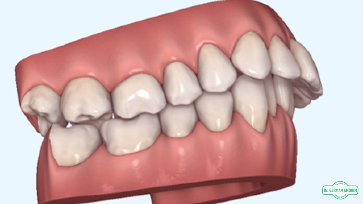 Estudios completos para Ortodoncia