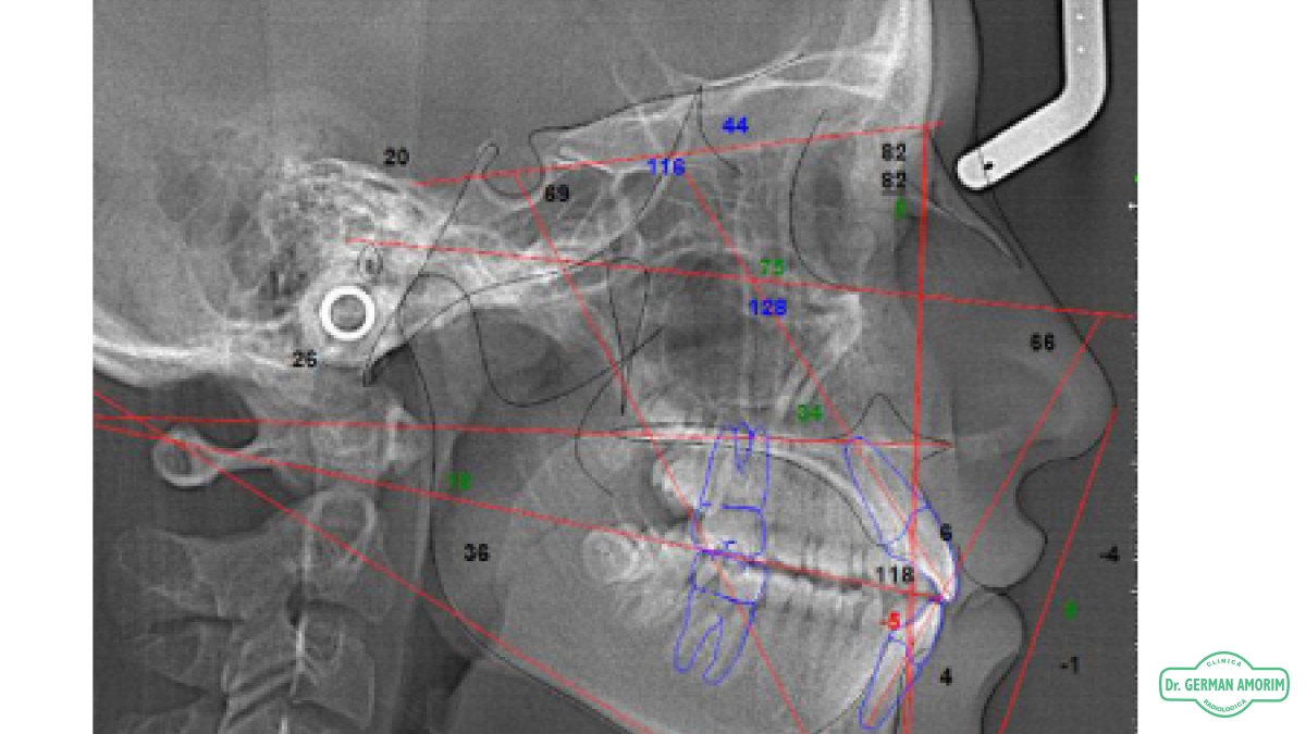 Estudios completos para Ortodoncia