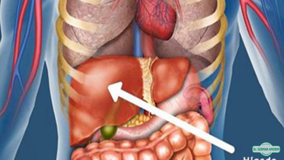 Ecografía de Punciones Hepáticas